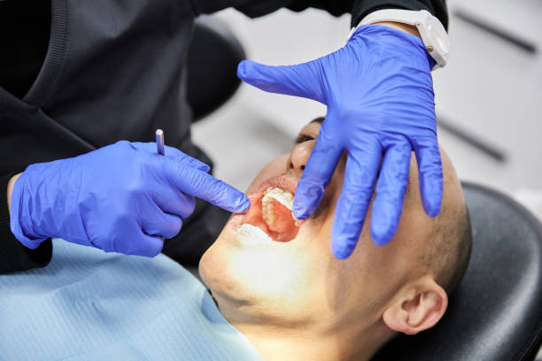 Best Broken or Chipped Tooth Repair in Norwood, OK